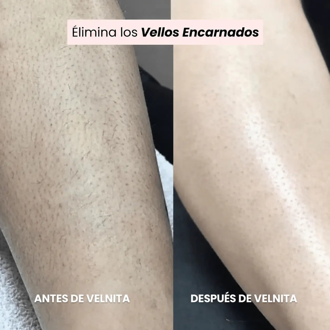 Afeitadora Velnita®