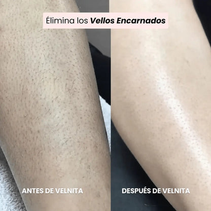 Afeitadora Velnita®