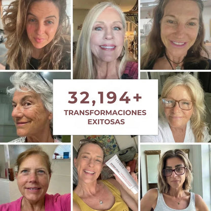 Velnita™ Crema Age Reset