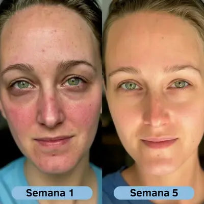 VoluFine | Sérum coreano de colágeno para piel madura