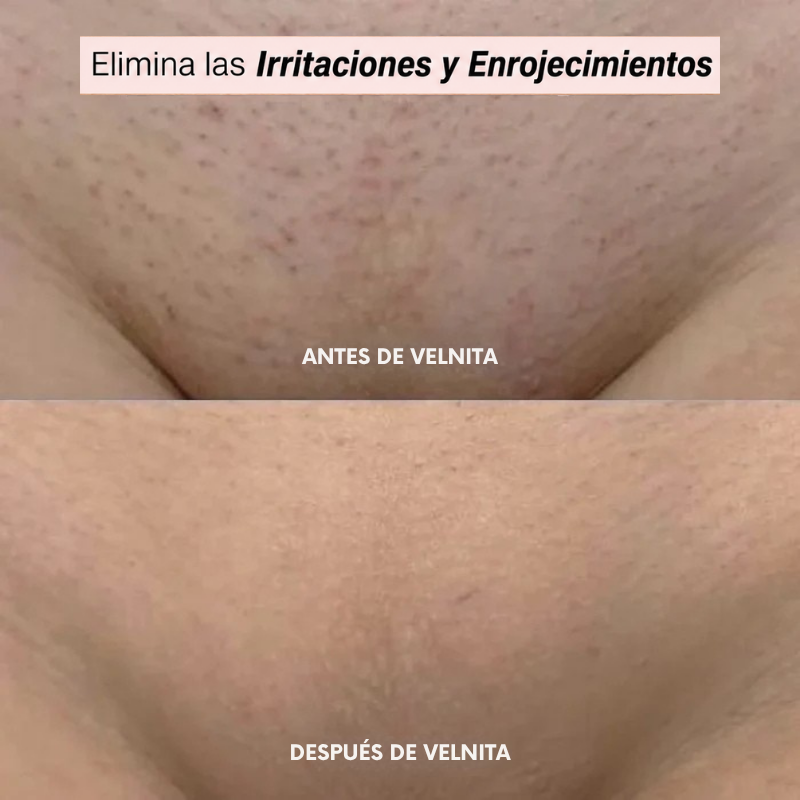 Afeitadora Velnita®