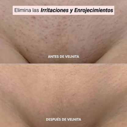 Afeitadora Velnita®
