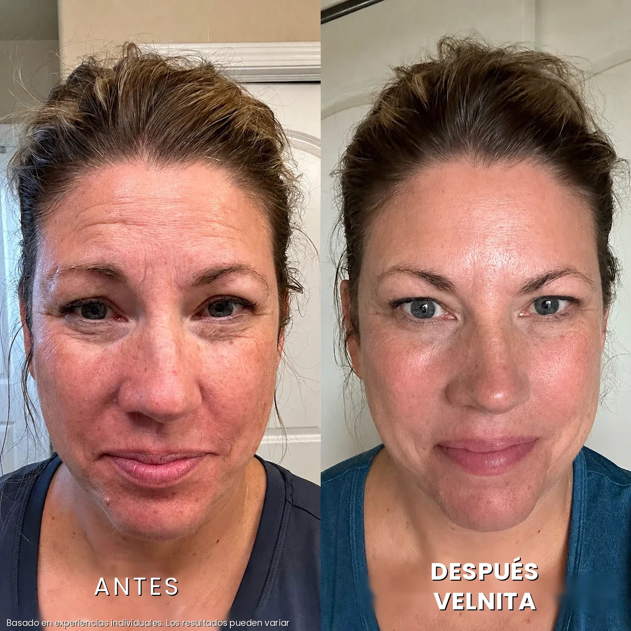 Antes / Después 1