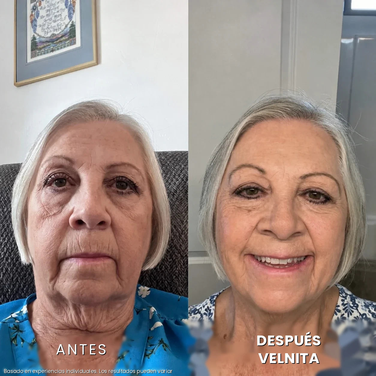 Antes / Después 2