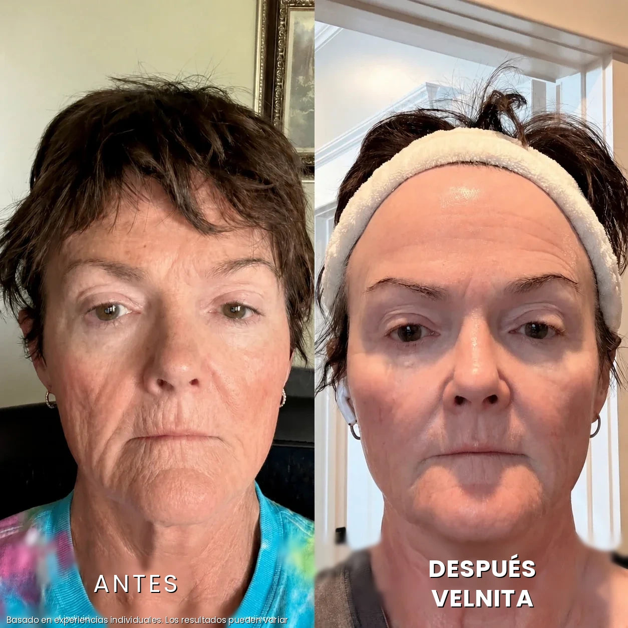 Antes / Después 3