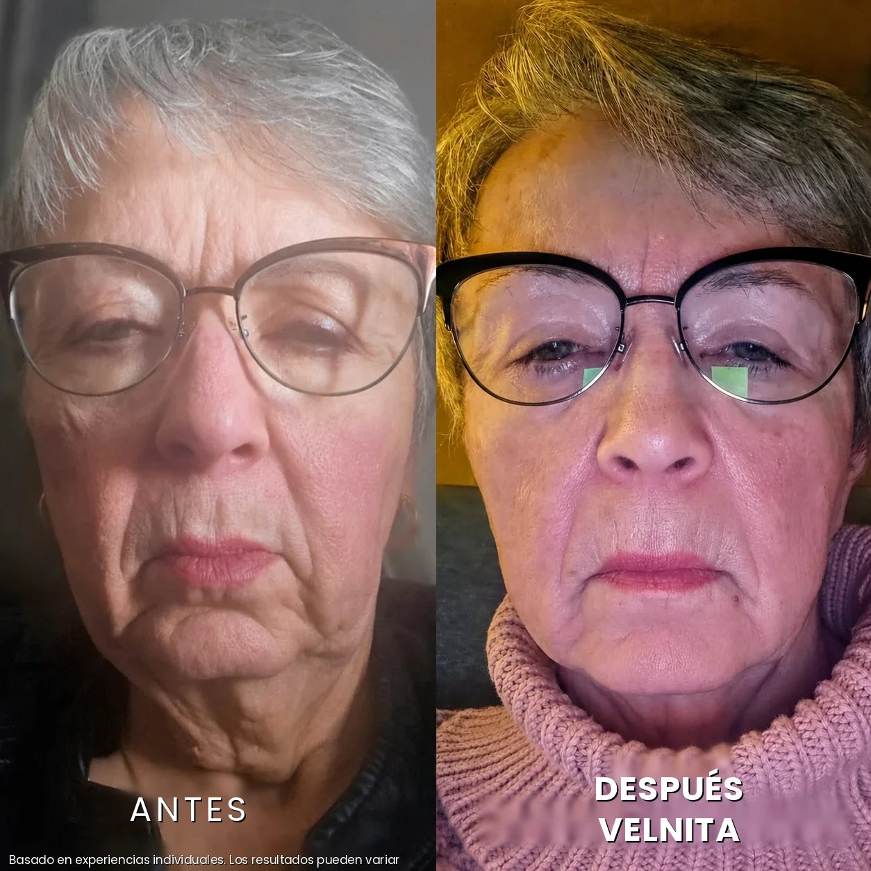 Antes / Después 4