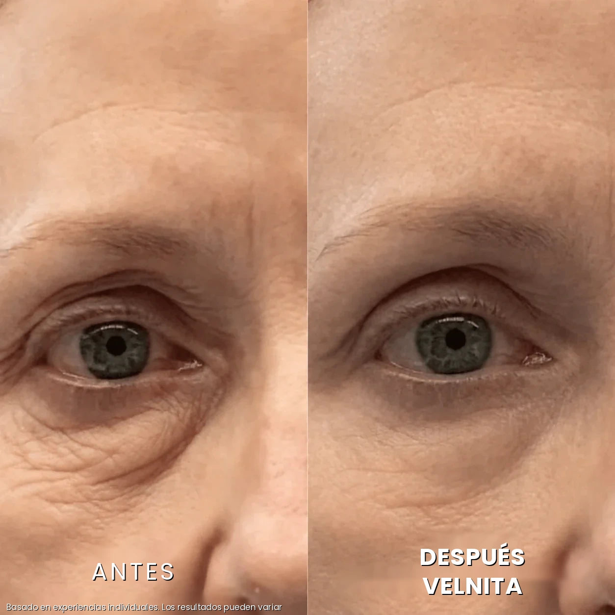 Antes / Después 5