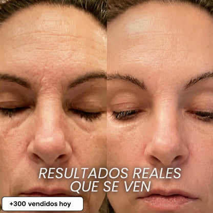 STICK REPULPANTE BIO-COLÁGENO PDRN