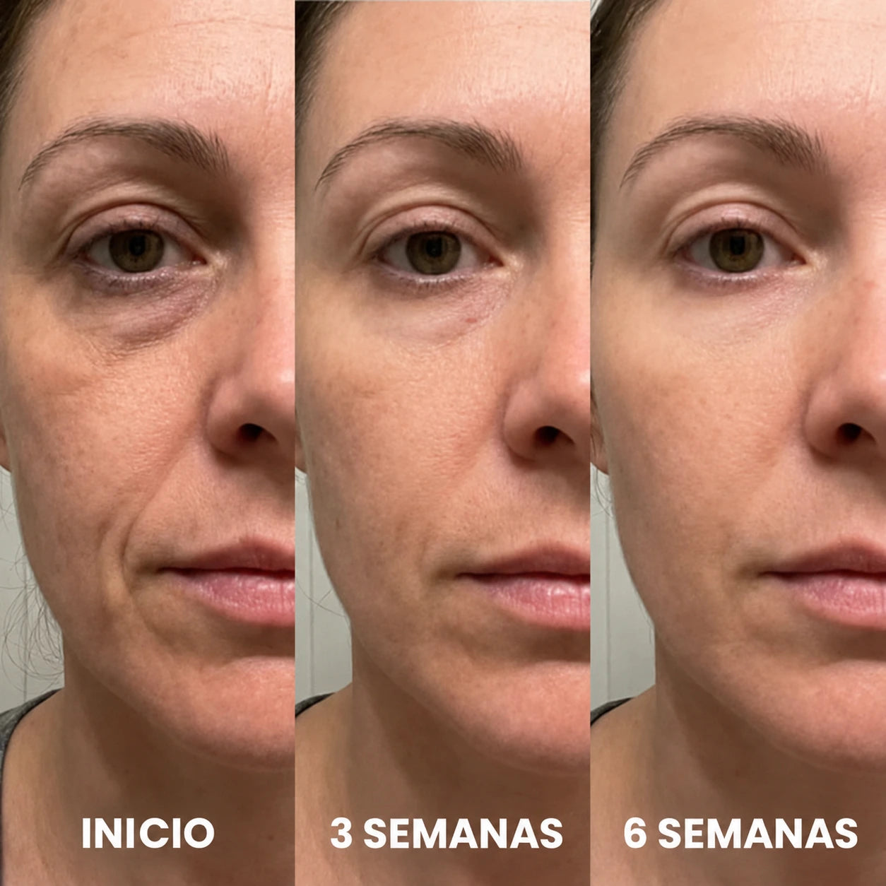 Resultados al inicio, después de 3 semanas y después de 6 semanas
